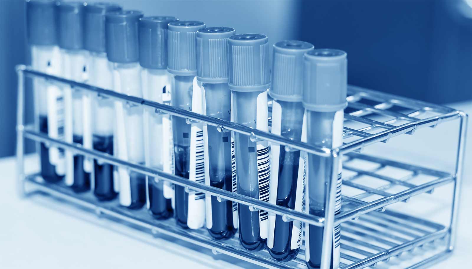 Sample Management BioPharma EurofinsViracor