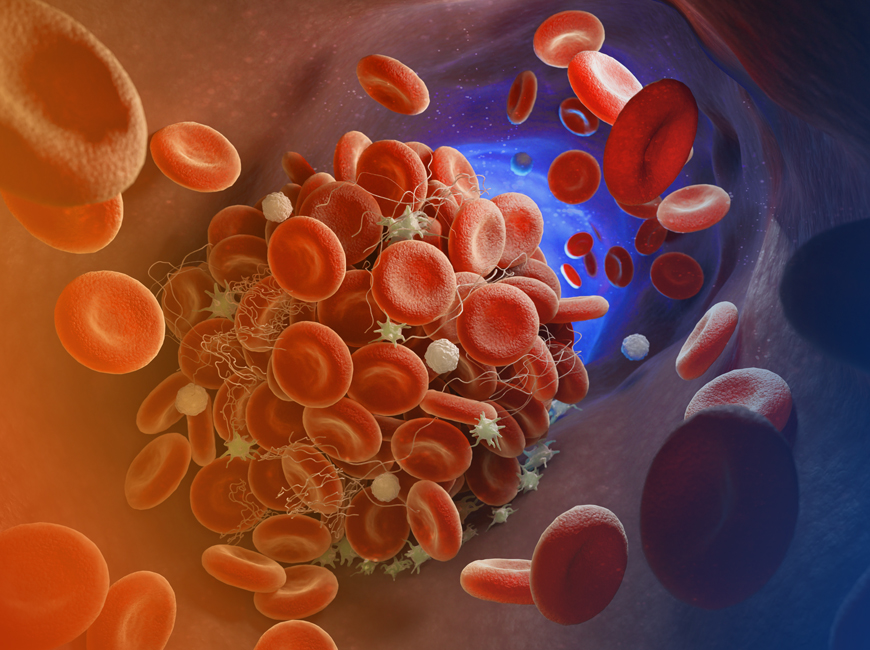  TA-TMA Transplant-associated thrombotic microangiopathy