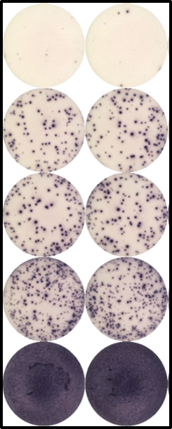 ELISpot enzymelinked immune absorbent spot testing services